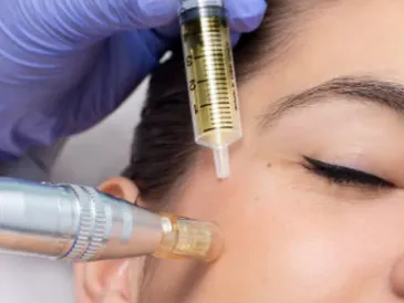  DERMAPEN