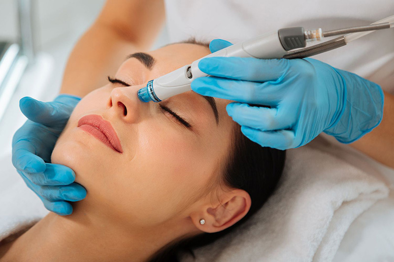  LIMPIEZA HYDROFACIAL